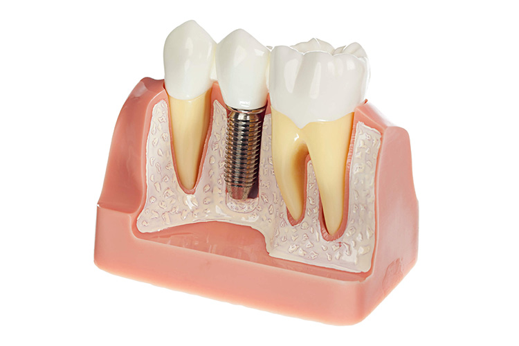 Γενική οδοντιατρική